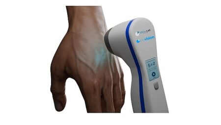 Üniversite öğrencisi babasının hastalığından yola çıkarak vitiligo tedavisi için aygıt geliştirdi